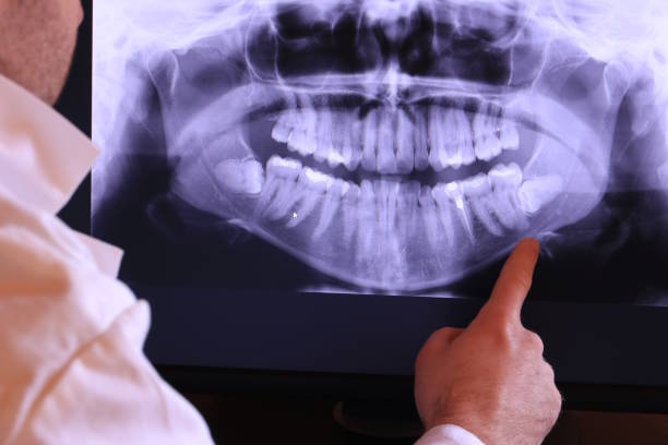 Best Orthodontic Emergency Dentist in Hartselle, AL