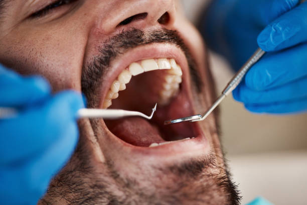 Best Mobile Emergency Dentist in Hartselle, AL